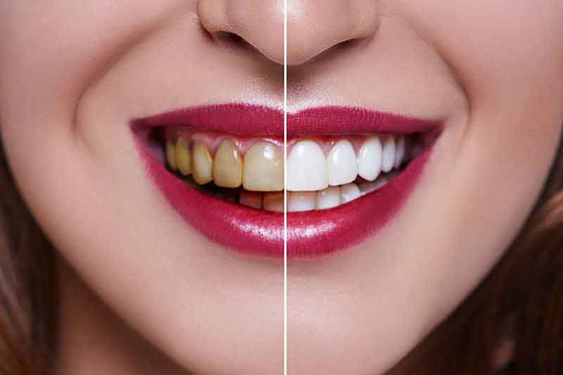 HOLLYWOOD SMILE - DOSTUPAN SVIMA!